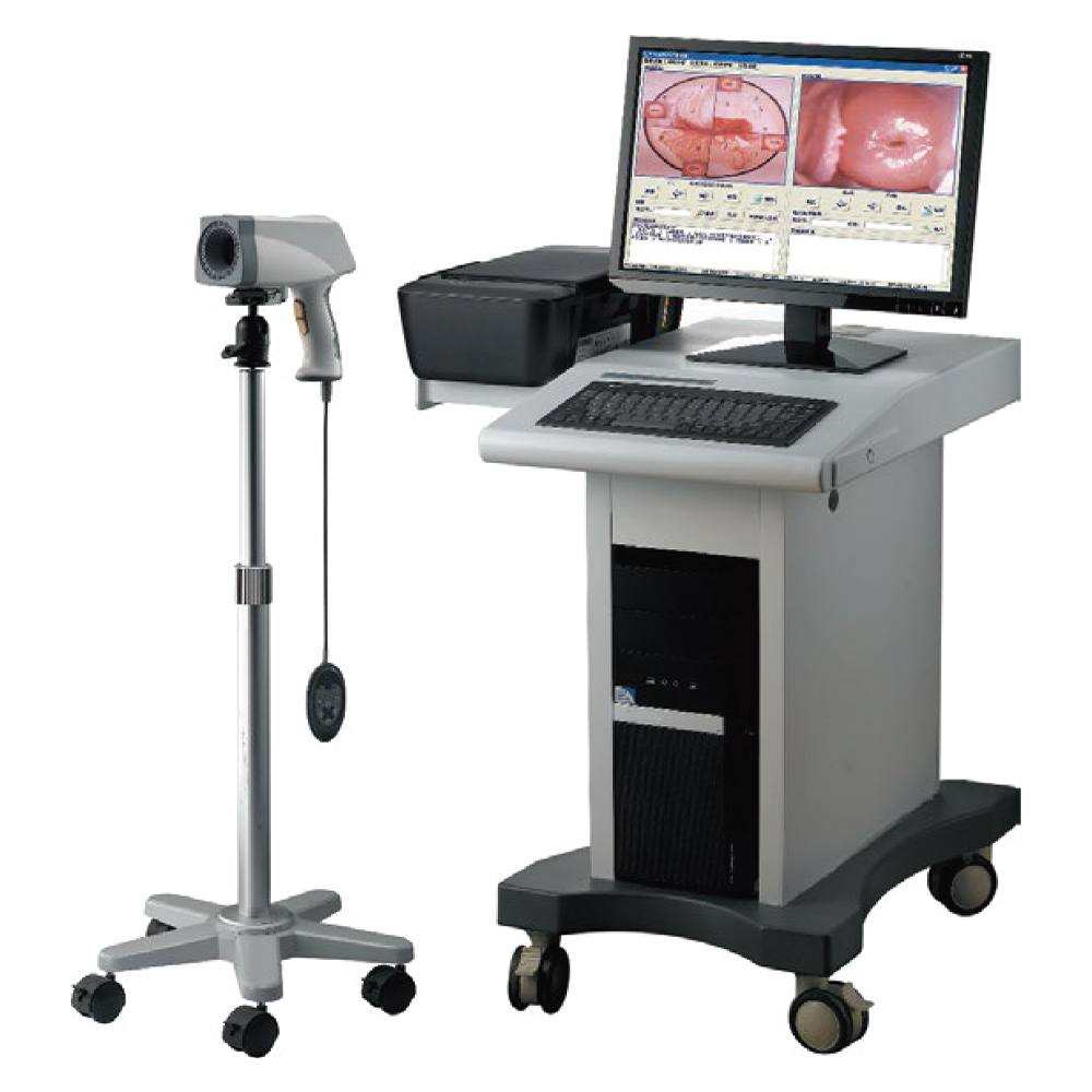 Digital-Colposcope