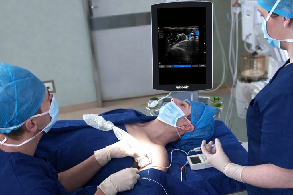 medical professionals are performing a procedure with the Navi ultrasound system, as the ultrasound screen displays detailed tissue imaging during the procedure
