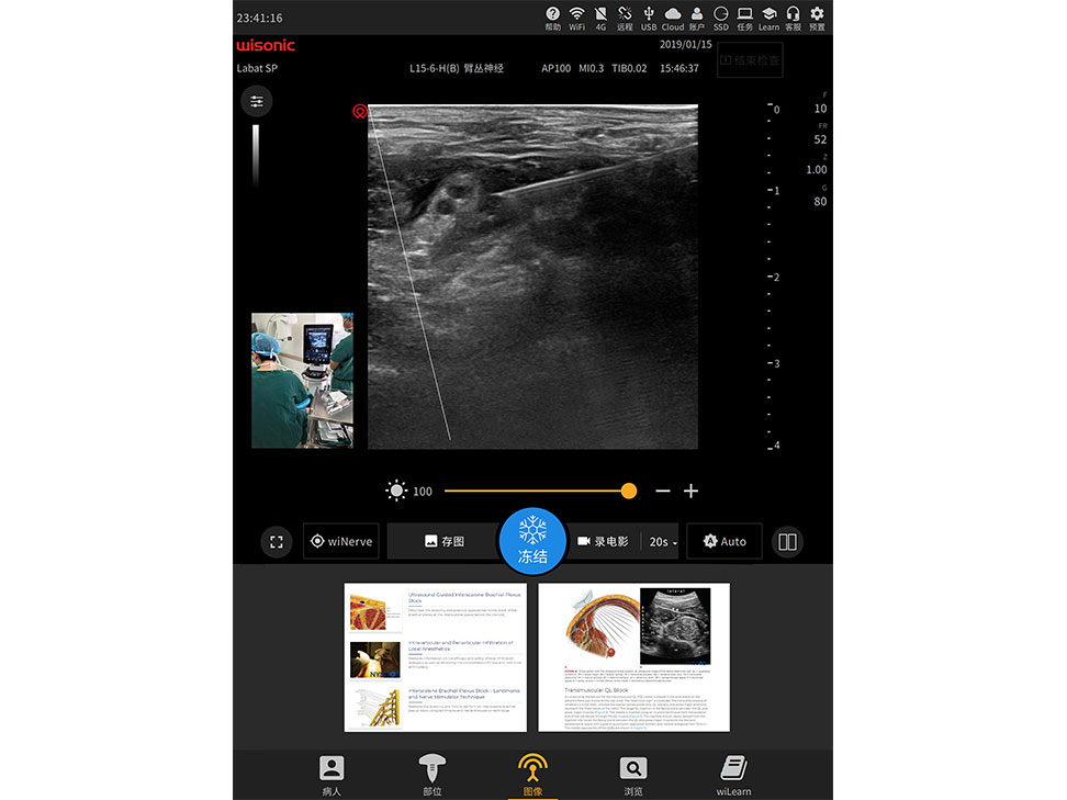 Labat ultrasound system being used in a clinical environment, displaying an image with a clear view of muscle tissue and the controls for navigation
