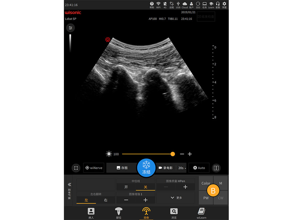 Ultrasound image showing a clear view of an organ or tissue with the Labat system interface, including controls for settings like brightness and mode.