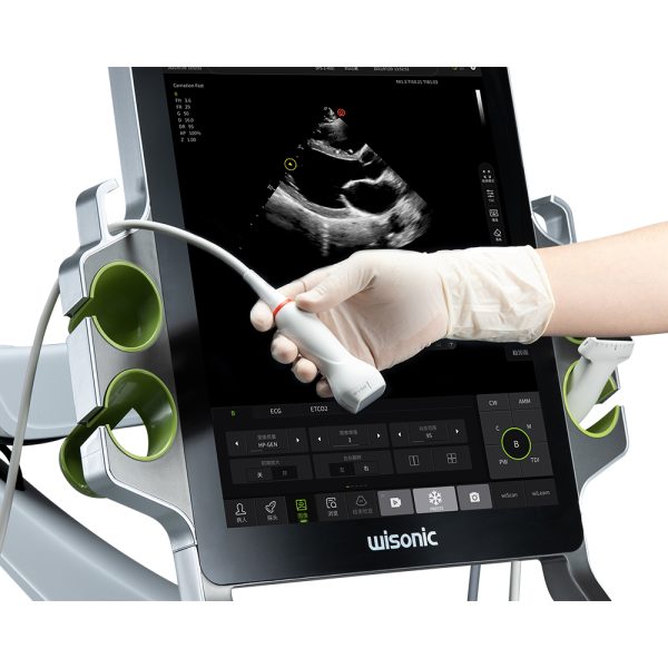 Critical Care Ultrasound - Image 5