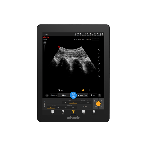 Anesthesia & Pain Management Ultrasound - Image 8
