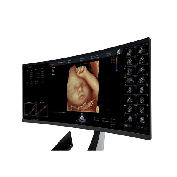 OB & GYN - Obstetrics and gynecology ultrasound - Image 4