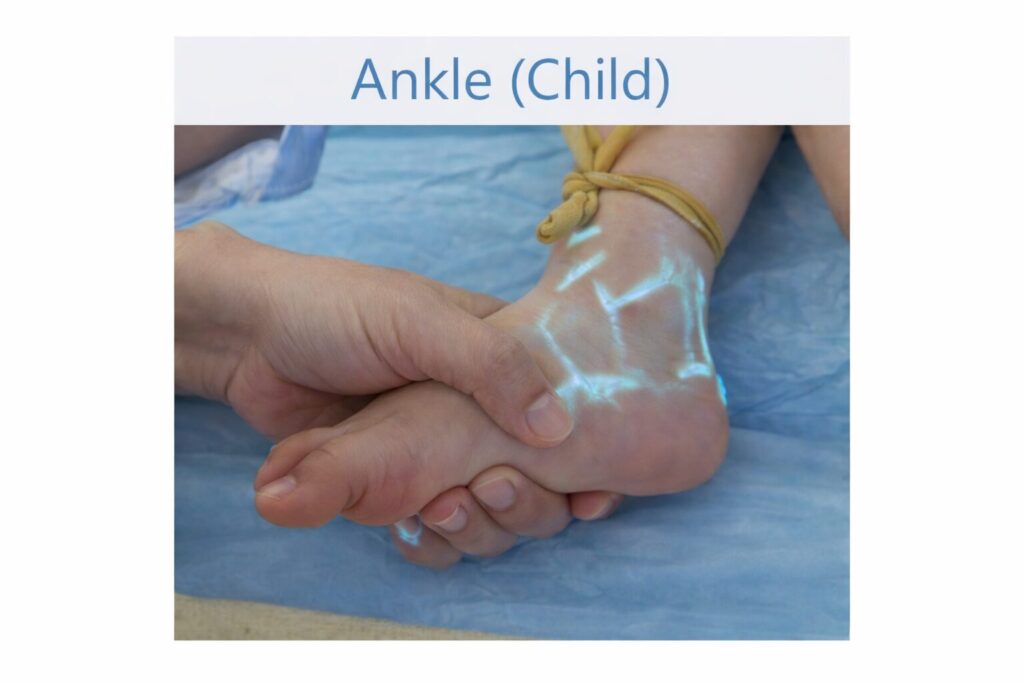 Vein projection on a child's ankle using the Amoul Vein Finder VS1400.